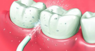 Irrigateur oral - qui est préférable de choisir et pourquoi vous en avez besoin